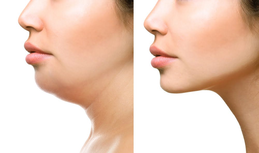 How do you lose body fat without affecting face fat