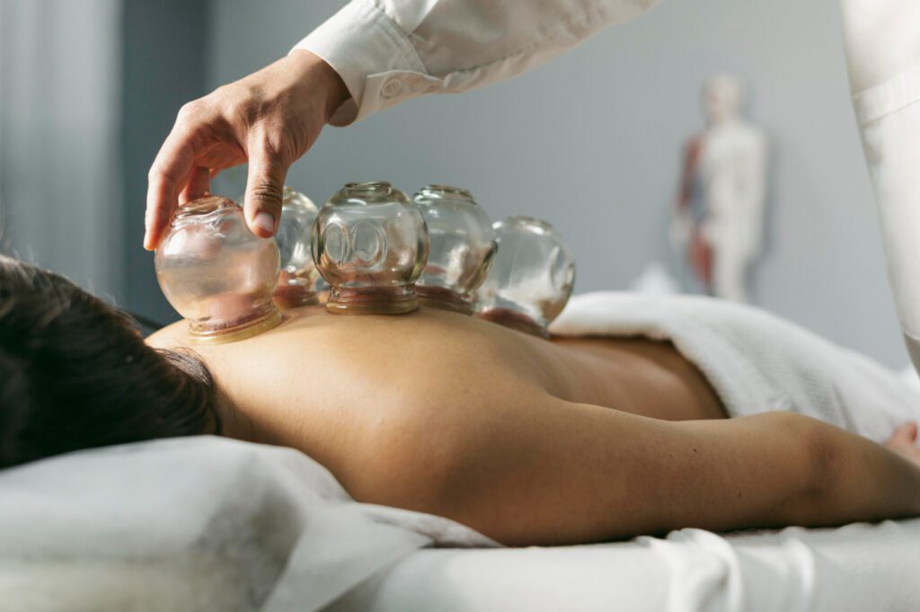 How To Do Cupping Therapy at Home