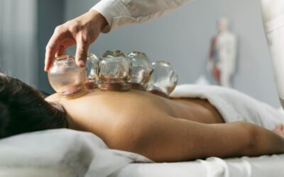 How To Do Cupping Therapy at Home